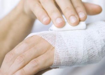 هل يمكن علاج الحروق بعسل النحل؟