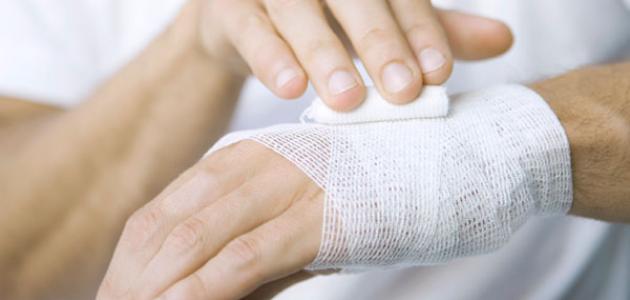 هل يمكن علاج الحروق بعسل النحل؟