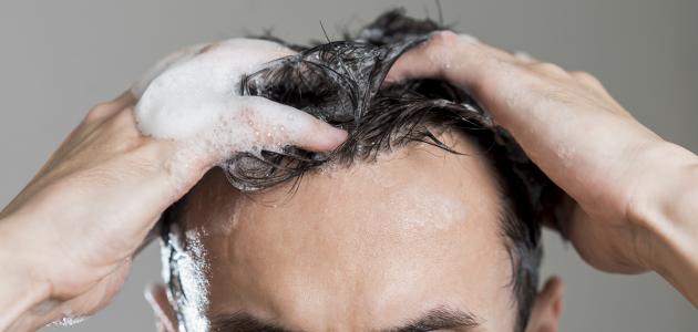 كيف تتخلص من رائحة الشعر الكريهة وما أسبابها؟