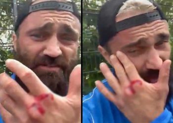 ملاكم تركي يتعرض مجددًا للاعتداء