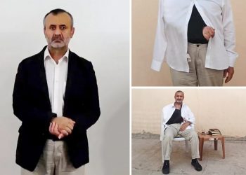 بعد تعذيبه.. تركي اختطفته المخابرات غير قادر على استخدام ذراعه اليمنى