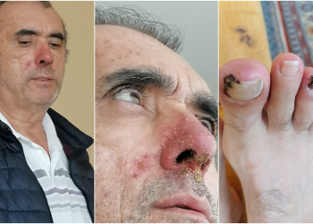 حرمان مريض سرطان معتقل من تلقي الدواء