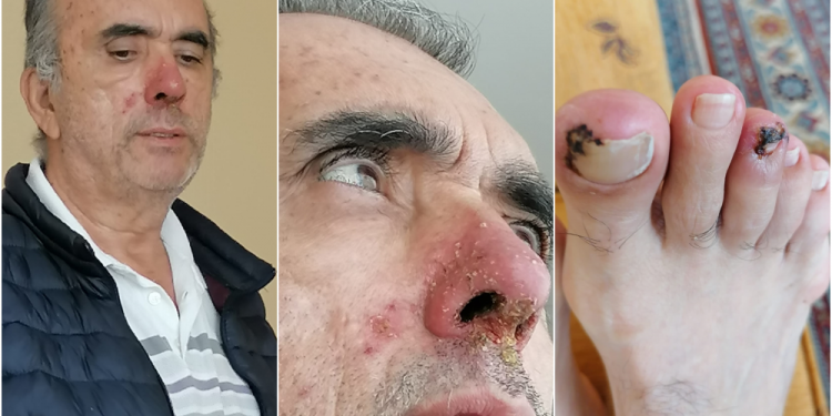 حرمان مريض سرطان معتقل من تلقي الدواء