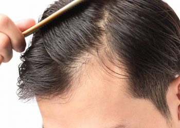 في أجسادنا نعمة اسمها “الشعر”!