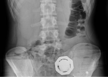 يقطعون مسافة 500 كيلومتر بمعدة ممتلئة بالهروين