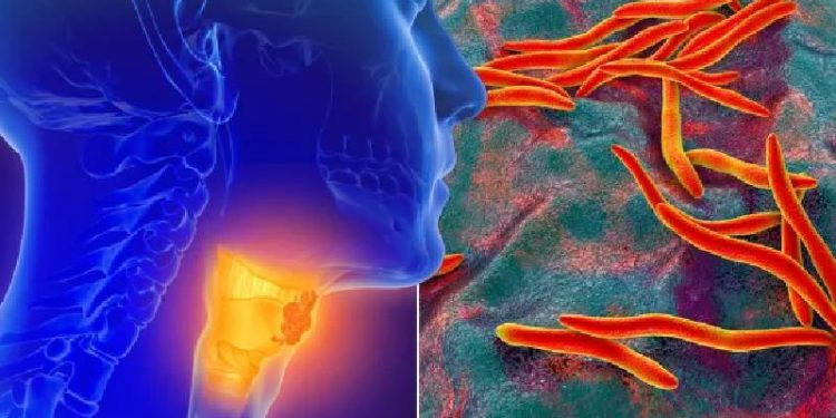 اكتشاف بكتيريا قادرة على تدمير 99% من الخلايا السرطانية