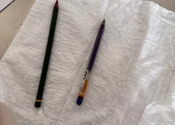 تركيا.. طبيبان يخرجان قلمين من معدة امرأة