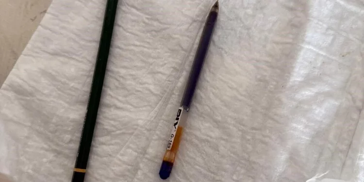 تركيا.. طبيبان يخرجان قلمين من معدة امرأة