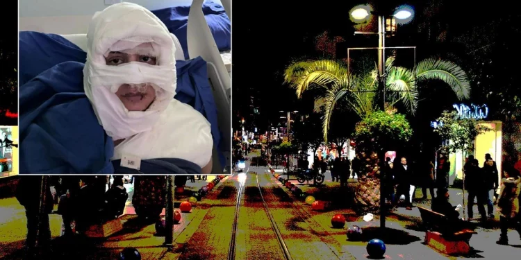 شابة تتعرض لهجوم بمادة مشتعلة في كاديكوي