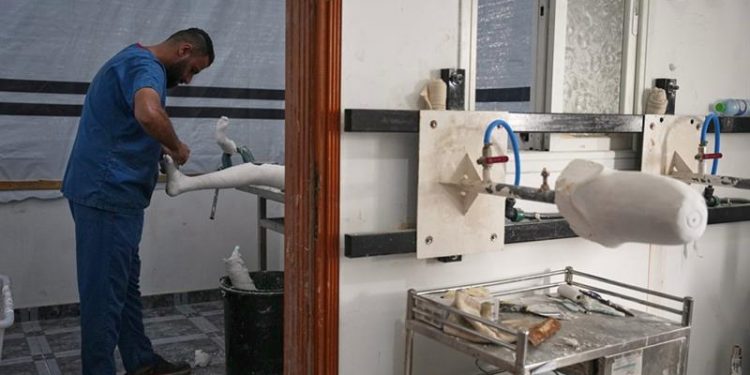 ضحايا حرب غزة يواجهون نقصًا حادًا في الأطراف الاصطناعية